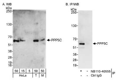 Western Blot: PP5 Antibody [NB110-40555]