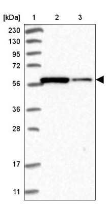 Western Blot: PP5 Antibody [NBP1-87240]