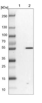 Western Blot: PP5 Antibody [NBP1-87240]