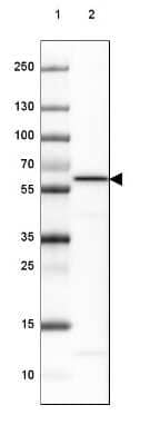 Western Blot: PP5 Antibody [NBP2-38812]