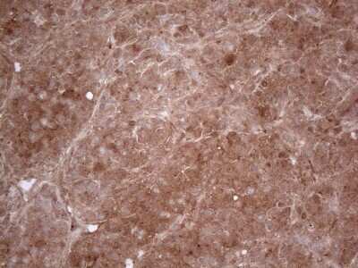 Immunohistochemistry: PPA2 Antibody (OTI7C1) [NBP2-45377]
