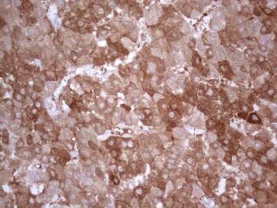 Immunohistochemistry: PPA2 Antibody (OTI7C1) [NBP2-45377]