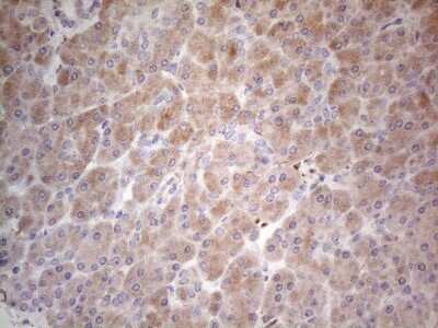 Immunohistochemistry: PPA2 Antibody (OTI7C1) [NBP2-45377]