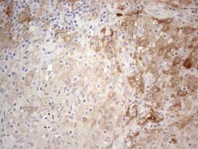 Immunohistochemistry: PPA2 Antibody (OTI7C1) [NBP2-45377]
