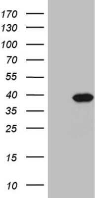 Western Blot: PPA2 Antibody (OTI7C1) [NBP2-45377]