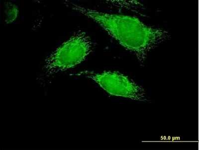 Immunocytochemistry/ Immunofluorescence: PPA2 Antibody [H00027068-B01P]