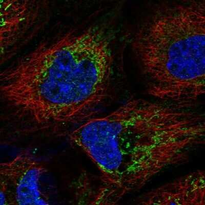 Immunocytochemistry/ Immunofluorescence: PPA2 Antibody [NBP1-82180]