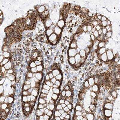 Immunohistochemistry-Paraffin: PPA2 Antibody [NBP1-82180]