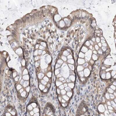 Immunohistochemistry-Paraffin: PPA2 Antibody [NBP2-38167]