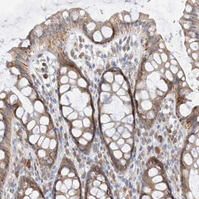 Immunohistochemistry-Paraffin: PPA2 Antibody [NBP2-38186]