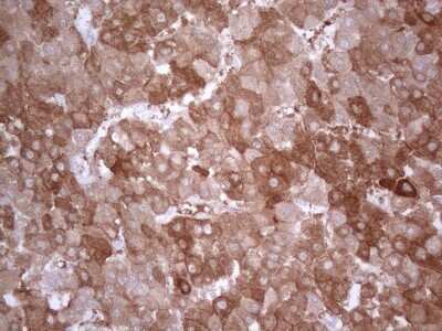 Immunohistochemistry: PPA2 Antibody (OTI7C1) - Azide and BSA Free [NBP2-73563]
