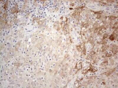 Immunohistochemistry: PPA2 Antibody (OTI7C1) - Azide and BSA Free [NBP2-73563]