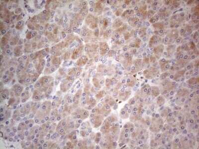Immunohistochemistry: PPA2 Antibody (OTI7C1) - Azide and BSA Free [NBP2-73563]