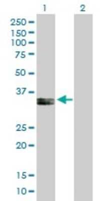 Western Blot: PPA2 Antibody [H00027068-B01P]