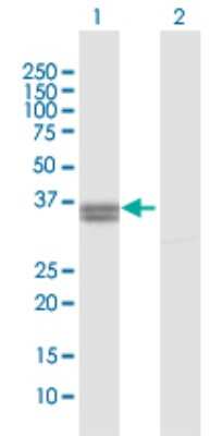 Western Blot: PPA2 Antibody [H00027068-D01P]