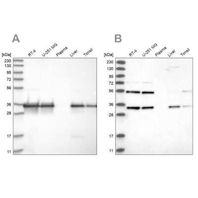 Western Blot: PPA2 Antibody [NBP1-82180]