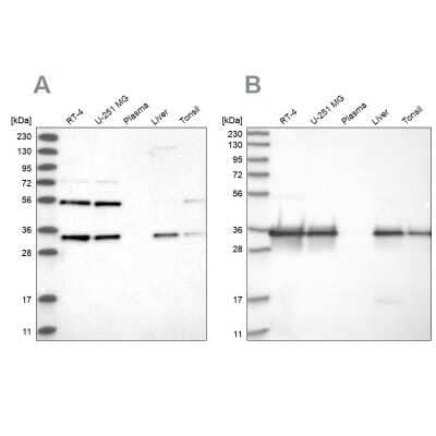 Western Blot: PPA2 Antibody [NBP2-38186]