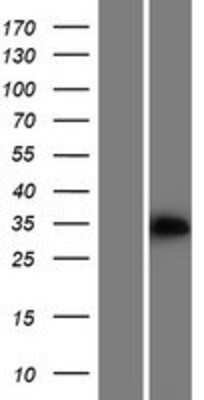 Western Blot: PPA2 Overexpression Lysate [NBP2-10031]