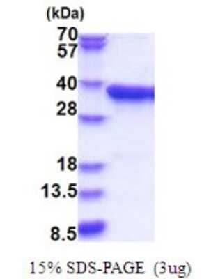 SDS-PAGE: Recombinant Human PPA2 His Protein [NBP2-51783]