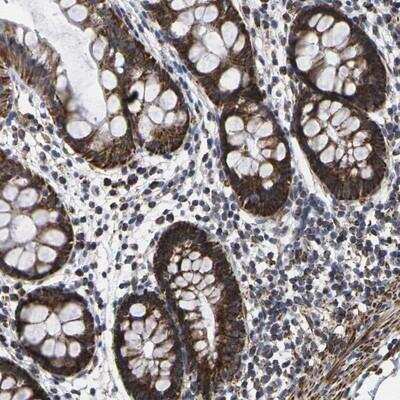 Immunohistochemistry: P2Y11/P2RY11 Antibody [NBP1-87465]