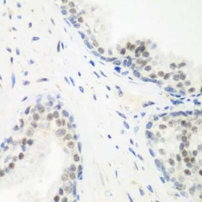 Immunohistochemistry-Paraffin: PPAN Antibody - BSA Free [NBP2-93075]