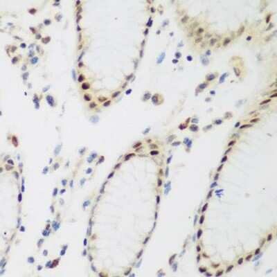 Immunohistochemistry-Paraffin: PPAN Antibody - BSA Free [NBP2-93075]
