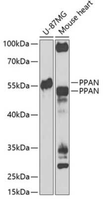 Western Blot: PPAN AntibodyBSA Free [NBP2-93075]