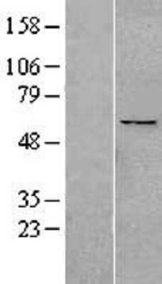 Western Blot: PPAN Overexpression Lysate [NBL1-14624]