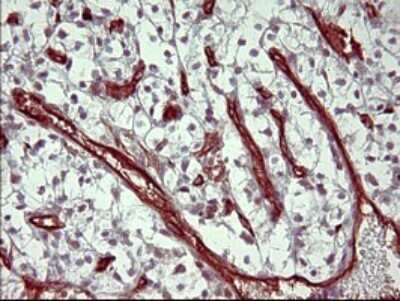 Immunohistochemistry: PPAP2A Antibody (OTI1H4) [NBP2-45378]