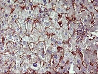 Immunohistochemistry: PPAP2A Antibody (OTI1H4) [NBP2-45378]