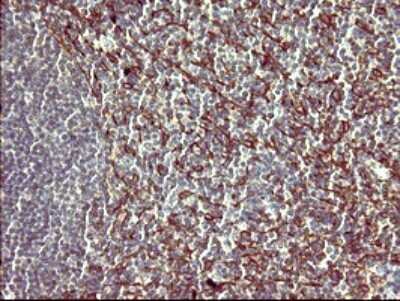 Immunohistochemistry: PPAP2A Antibody (OTI1H4) [NBP2-45378]