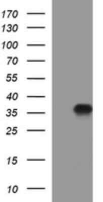 Western Blot: PPAP2A Antibody (OTI1H4) [NBP2-45378]