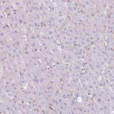 Immunohistochemistry-Paraffin: PPAP2A Antibody [NBP2-32057]