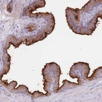 Immunohistochemistry-Paraffin: PPAP2A Antibody [NBP2-32057]