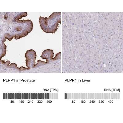 Immunohistochemistry-Paraffin: PPAP2A Antibody [NBP2-32057]
