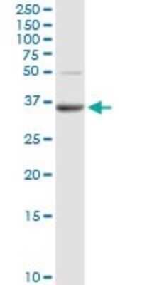 Western Blot: PPAP2A Antibody [H00008611-D01P]