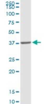 Western Blot: PPAP2A Antibody [H00008611-D01P]