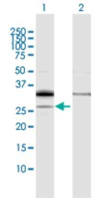 Western Blot: PPAP2A Antibody [H00008611-D01P]
