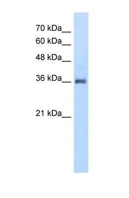 Western Blot: PPAP2A Antibody [NBP1-59011]