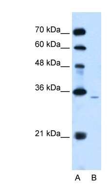 Western Blot: PPAP2A Antibody [NBP1-59025]