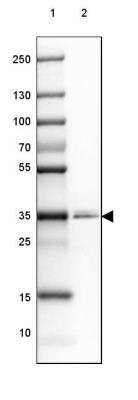 Western Blot: PPAP2A Antibody [NBP2-32057]