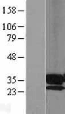 Western Blot: PPAP2A Overexpression Lysate [NBL1-14625]