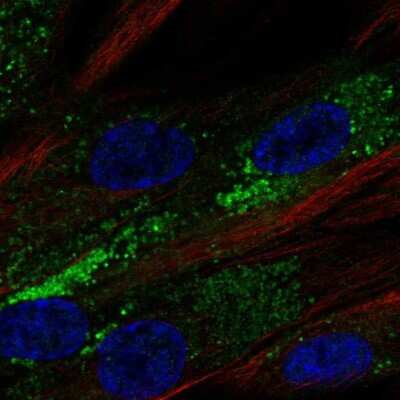 Immunocytochemistry/ Immunofluorescence: PPAP2B Antibody [NBP2-57350]