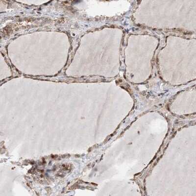 Immunohistochemistry-Paraffin: PPAP2B Antibody [NBP1-82825]