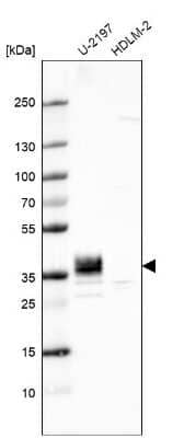 Western Blot: PPAP2B Antibody [NBP2-57350]