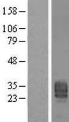 Western Blot: PPAP2B Overexpression Lysate [NBL1-14626]