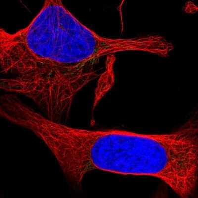 Immunocytochemistry/ Immunofluorescence: PPAP2C Antibody [NBP2-31607]