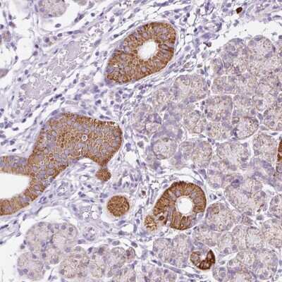 Immunohistochemistry-Paraffin: PPAP2C Antibody [NBP2-31607]