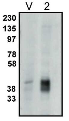 Western Blot: PPAP2C Antibody [NBP3-11903]