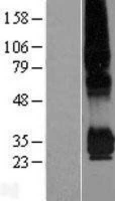 Western Blot: PPAP2C Overexpression Lysate [NBP2-07964]